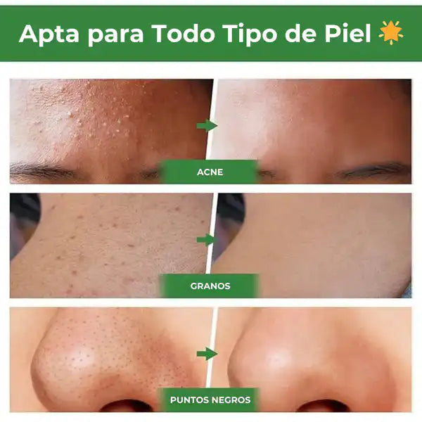 Green Stick™ | OFERTA 2X1 Mascarilla Facial Té Verde Exfoliante (2025)