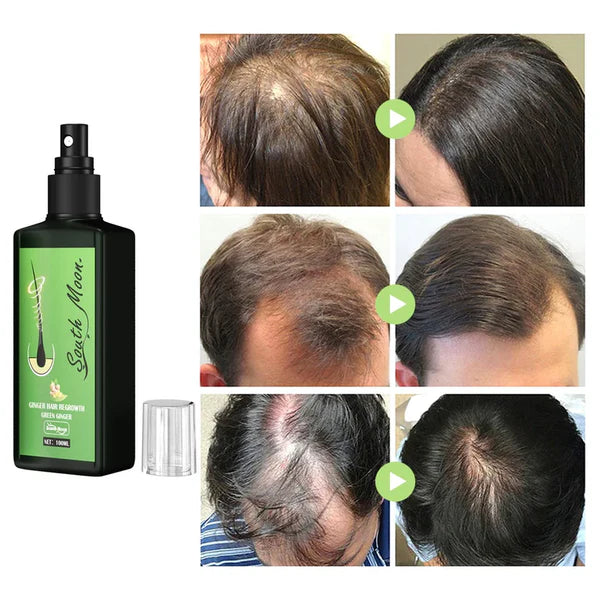 South Moon™ - OFERTA 2X1 Spray Revitalizante Intensivo