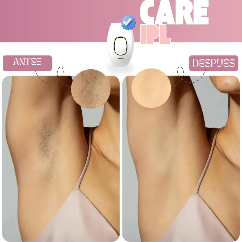 Depilación Profesional en Segundos - Care™ IPL